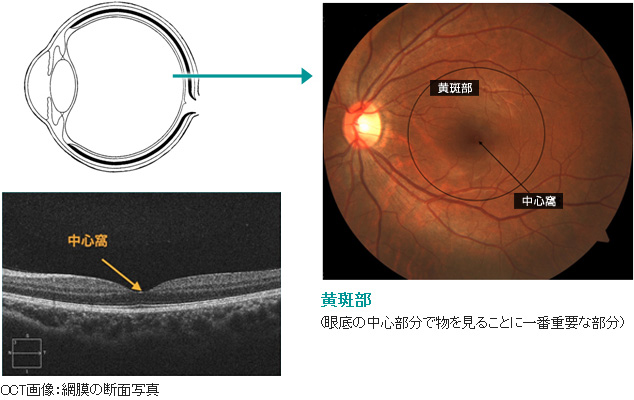 正常眼底所見写真